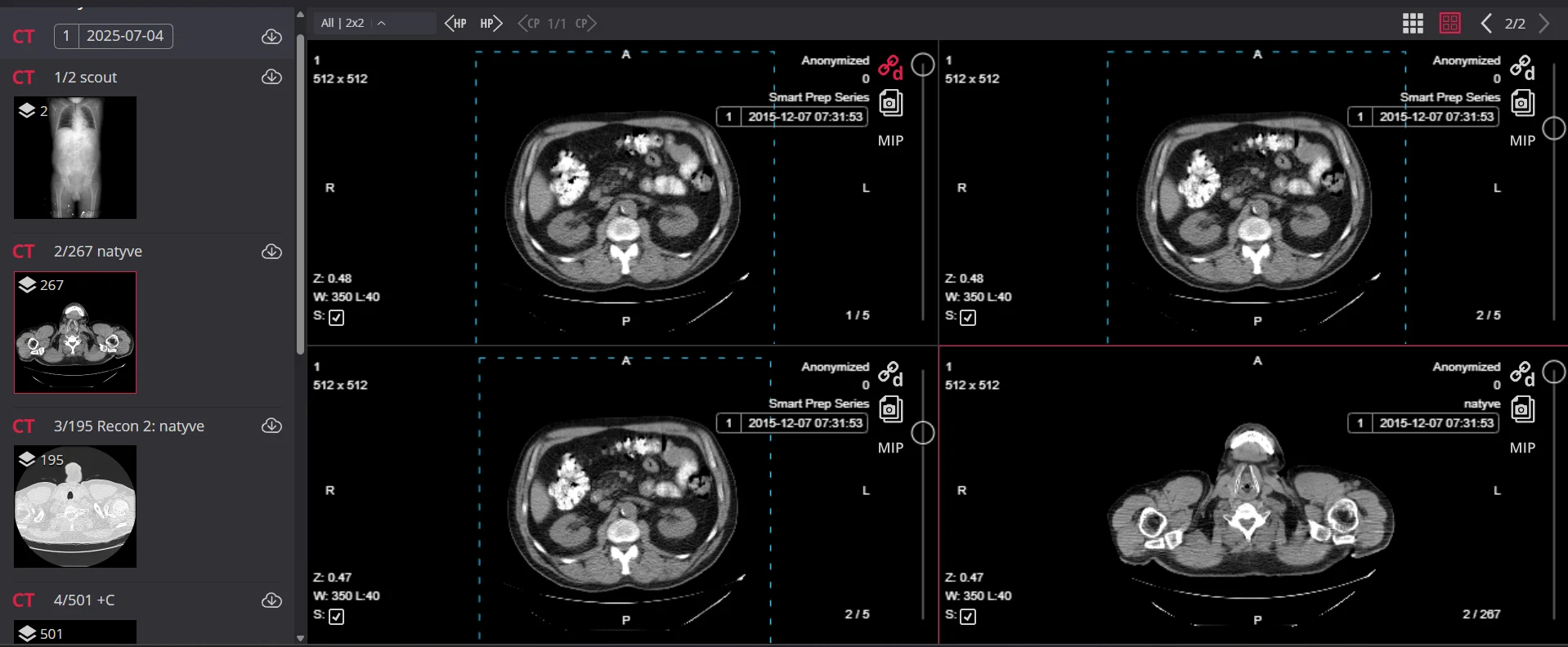 real DICOM viewer displaying multiple CT series